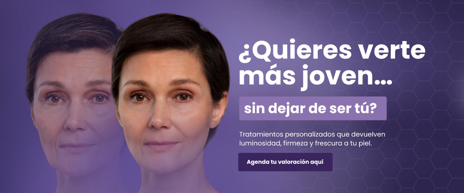 Dermatología banner yudy rejuvenercer 3