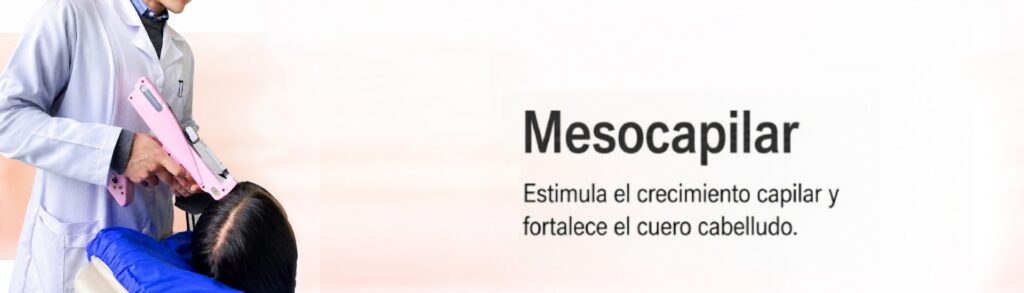 banners internos mesocapilar banners internos mesocapilar