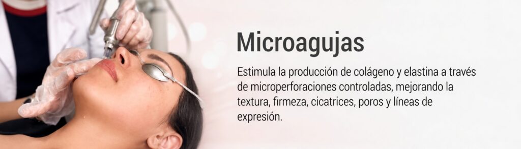 banners internos microagujas banners internos microagujas