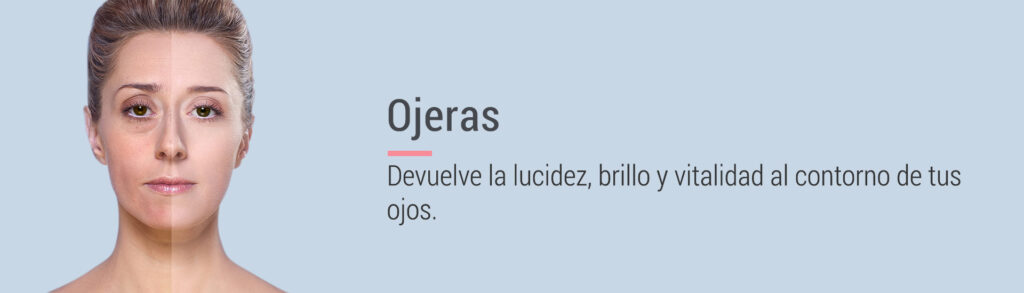 banners internos ojeras banners internos ojeras